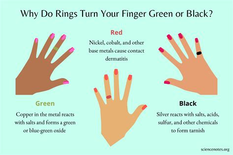 why do rings turn your finger black